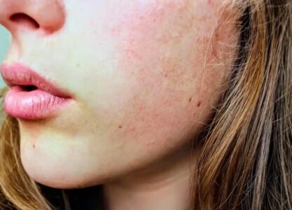 8 foods for skin health, according to a nutritionist