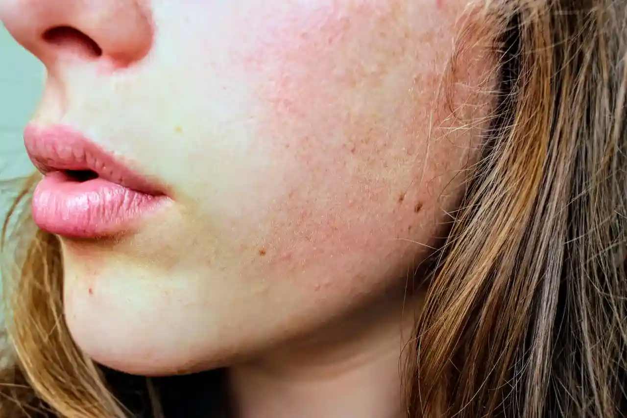 Foods That Naturally Improve Skin Complexion | Persona Blog